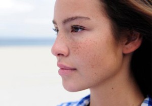 Mặt nạ giúp bạn cải thiện làn da bị nám và tàn nhang